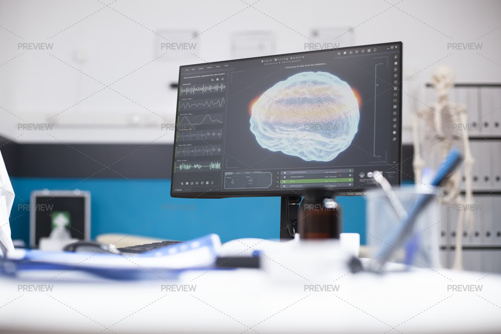 Desktop Monitor Displaying Brain Imaging - Stock Photos | Motion Array